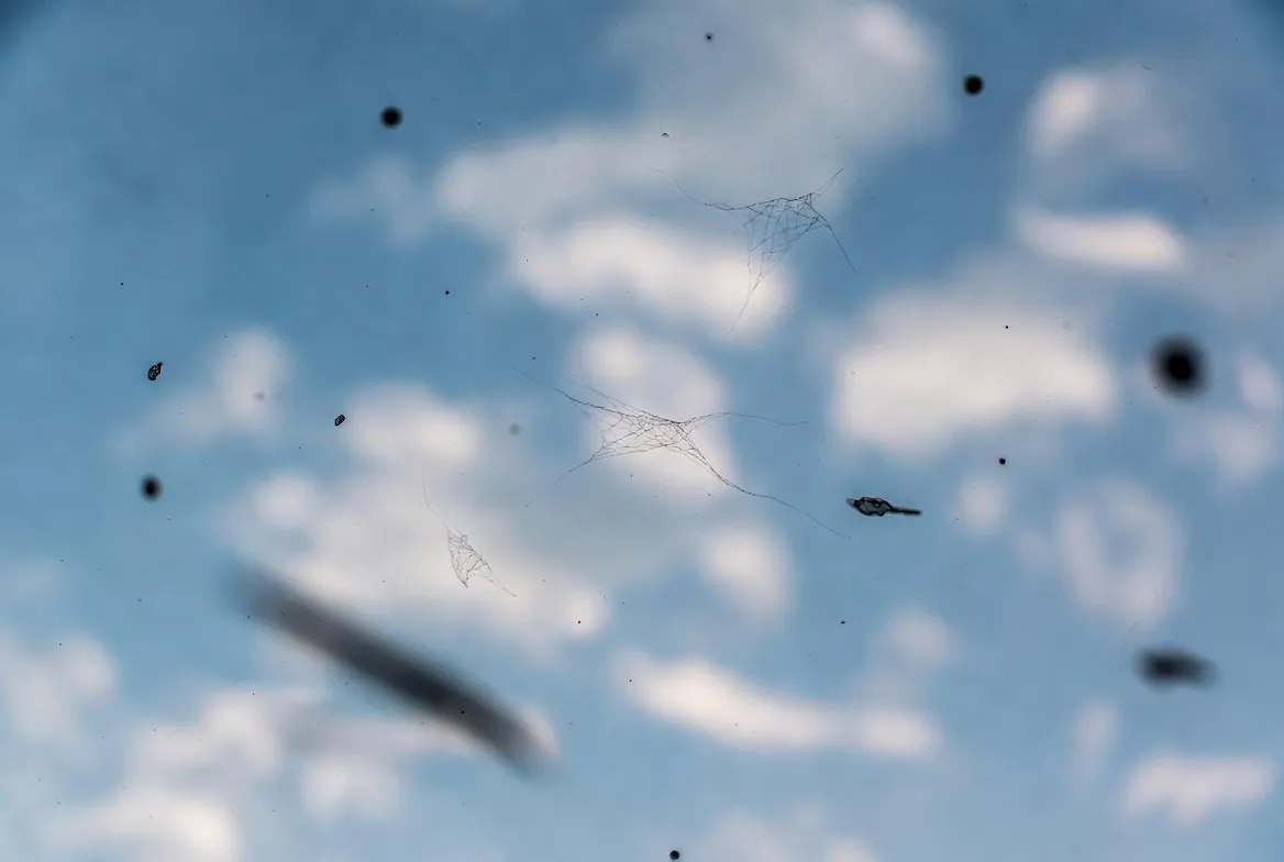 Pessoa observando pontos flutuantes na visão